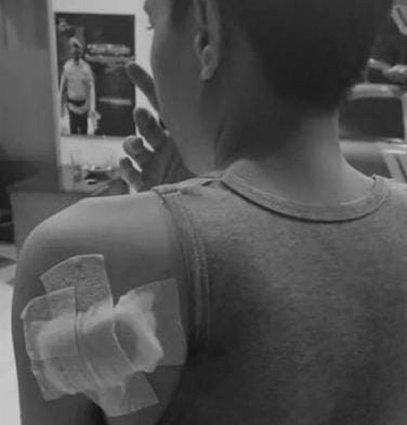 Begal Sadis Kembali Beraksi di Bekasi, Karyawan Swasta Dibacok Pakai Senjata Tajam