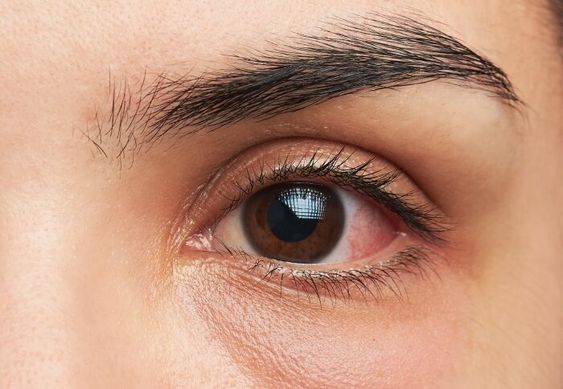 3 tips terpenting untuk menjaga kesehatan mata, lihat di sini