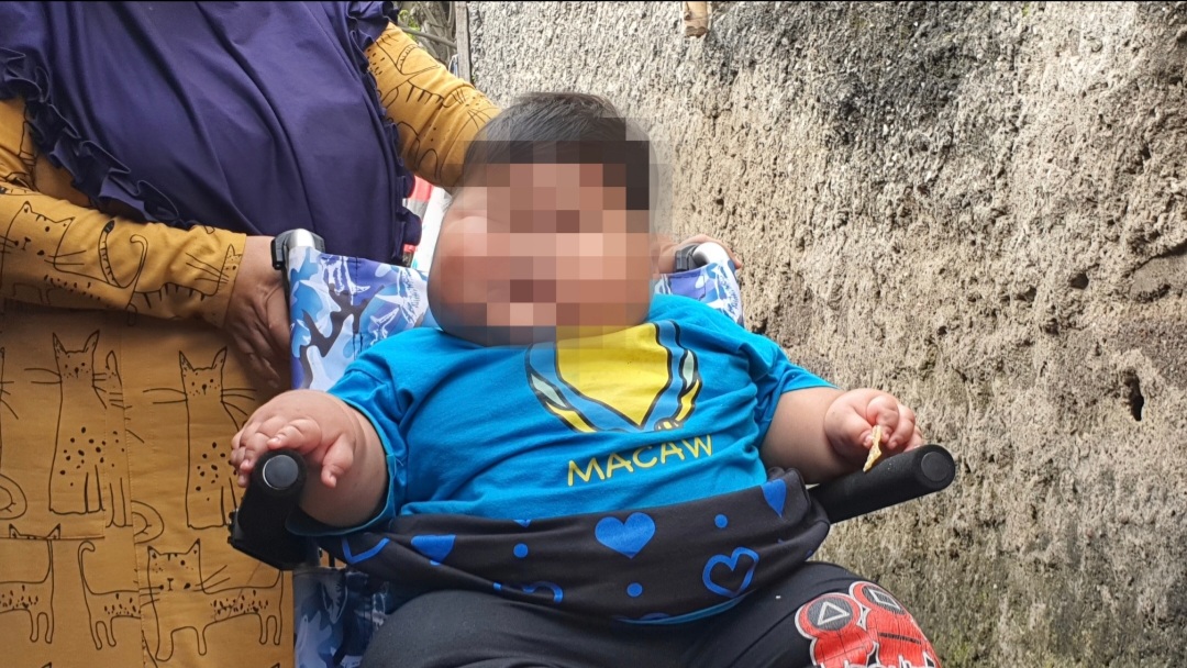 Kenzie Bayi Obesitas Dari Bekasi Kini Dalam Pengawasan Ketat Dokter Ahli RSCM, Daftar Makanan Harus Ditaati