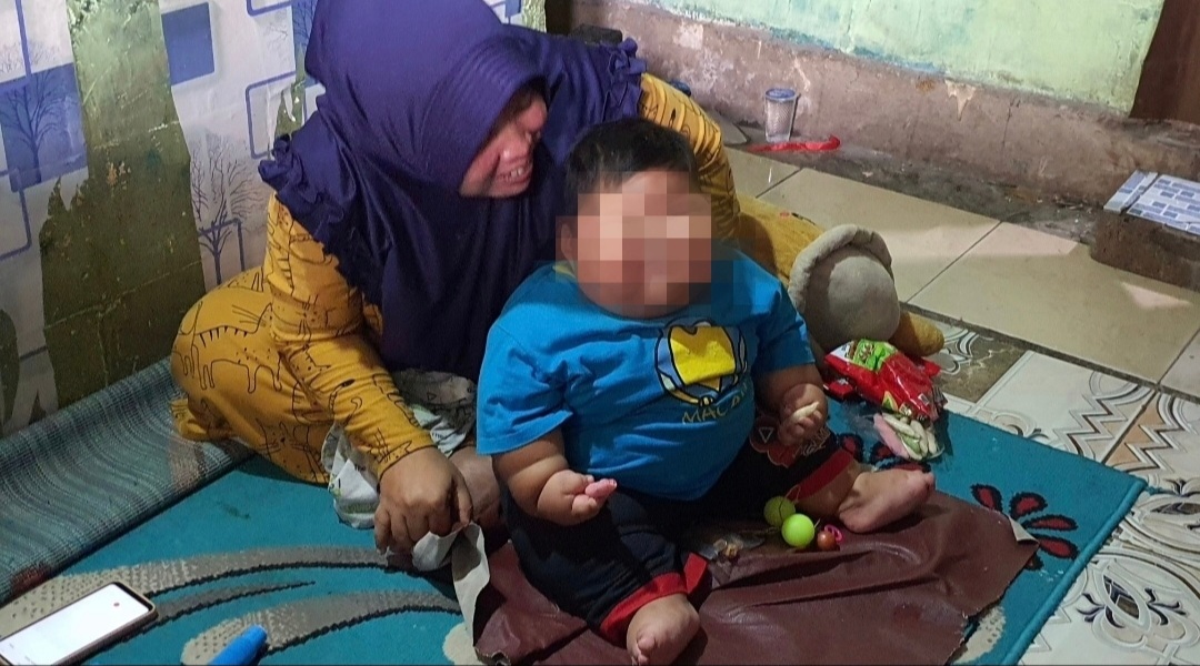 Rawat Jalan di RSCM Jakarta, Kenzie Bayi Obesitas dari Bekasi Berhasil Turunkan Berat Badan