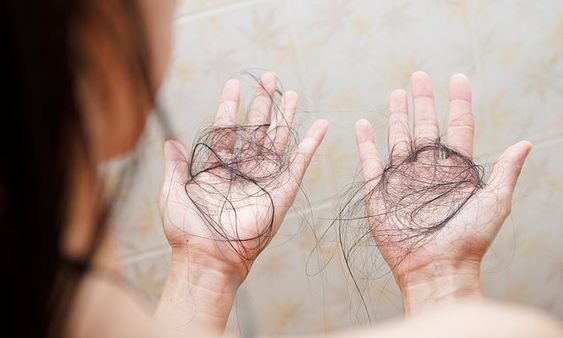 Trik Merawat Rambut agar Tidak Gampang Rontok, Nomor 3 Langsung Terbukti