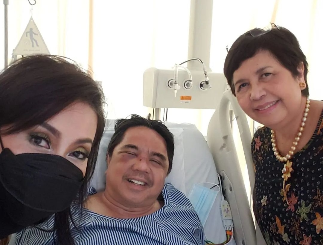 Kondisi Terkini Ade Armando Setelah Tiga Hari Dirawat di RS  