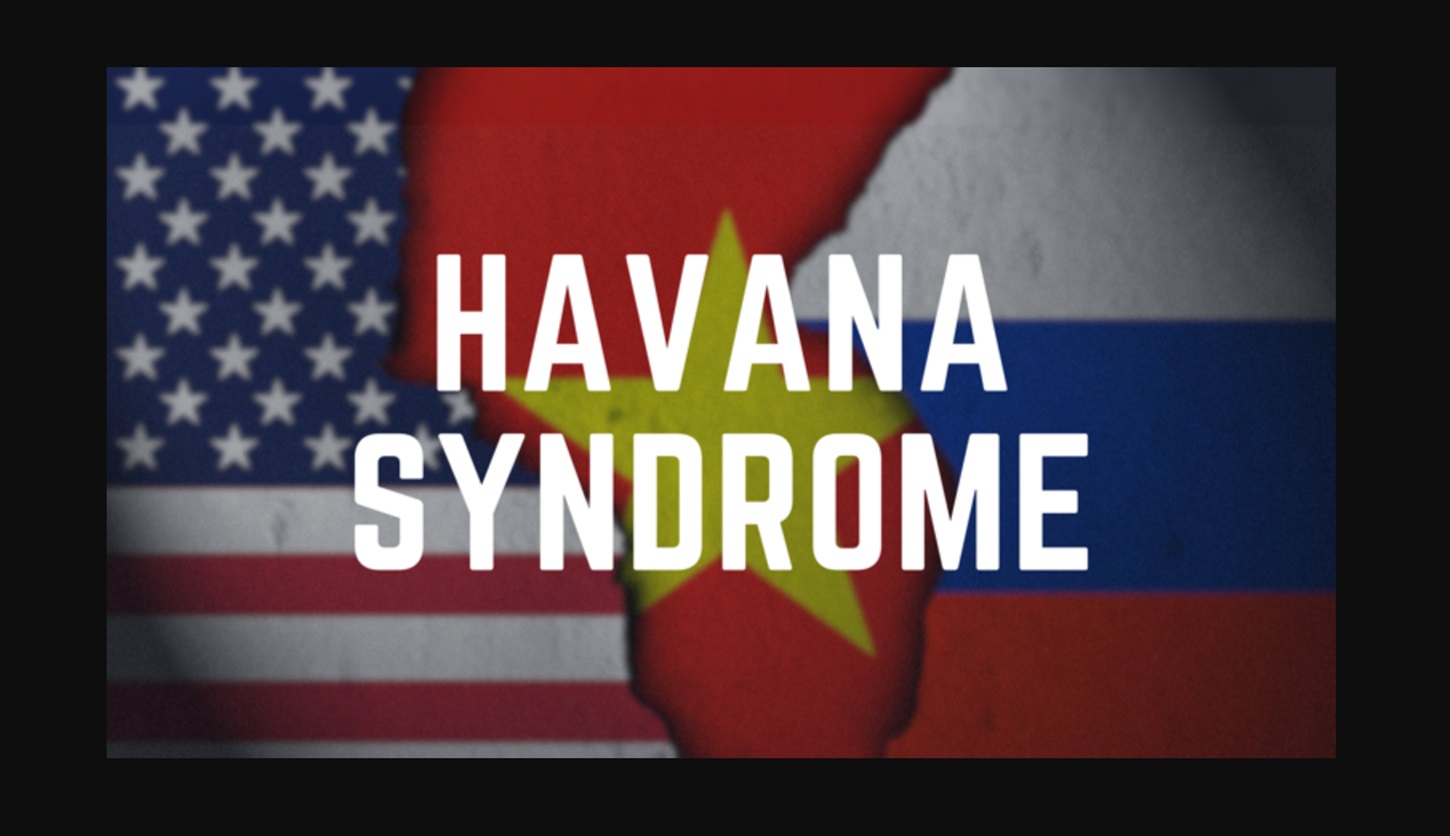 Intelijen militer Rusia Disebut Sebar Penyakit Sindrom Havana ke Diplomat Amerika 