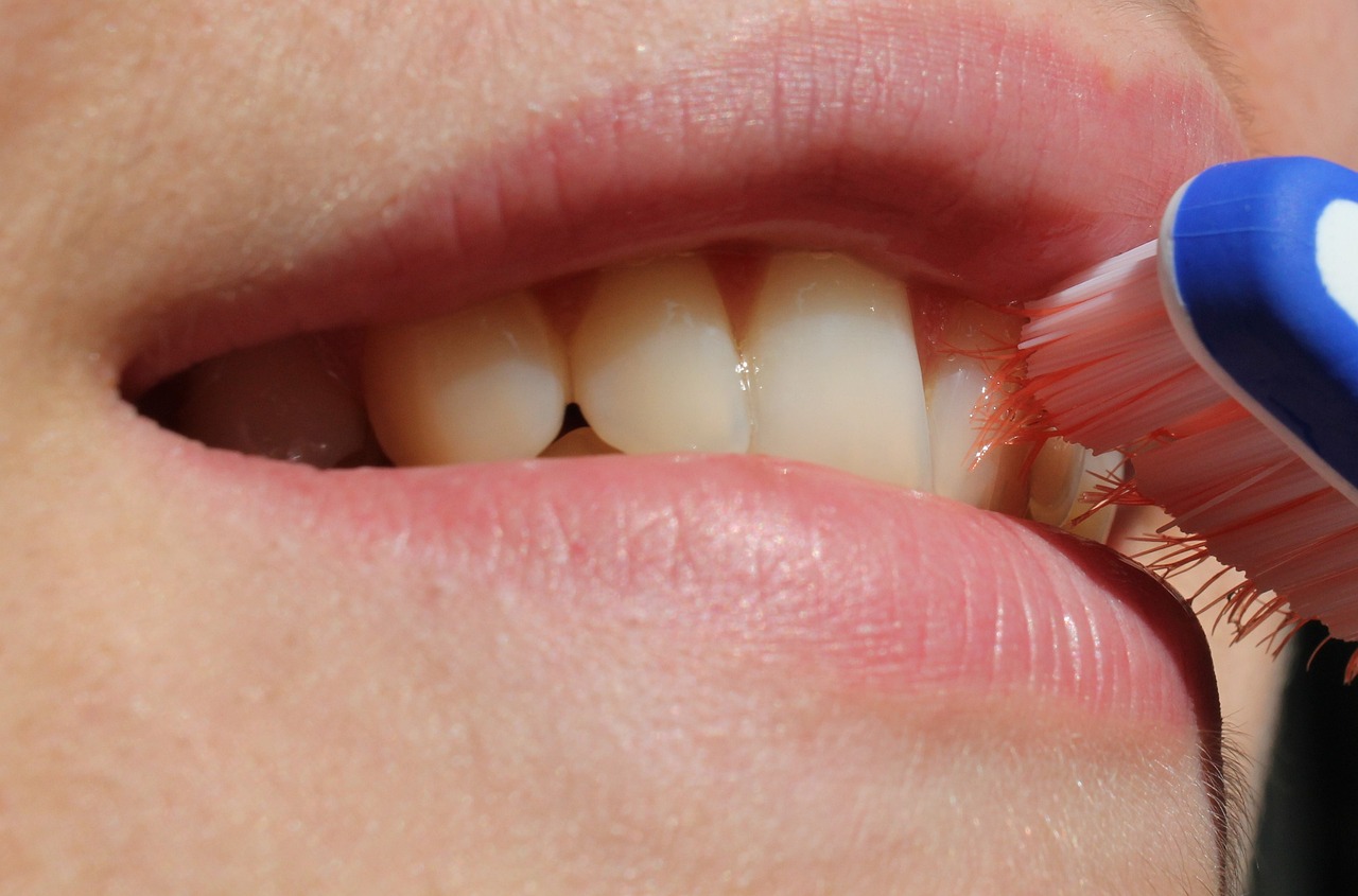 Risih dengan Gigi Kuning, Merapat Yuk, Begini 5 Tips Bersihkan Gigi Tanpa Pasta Gigi