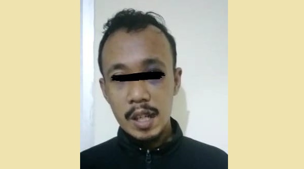 Pria Ini Mengaku Diculik dan Dipukuli Lalu Dibuang di Sukabumi, Hasil Penyeliidikan Polisi Temukan Fakta Ini