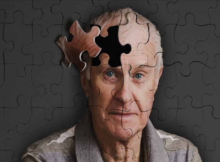 September, Momentum Tingkatkan Kesadaran Seputar Demensia, Kenali Alzheimer