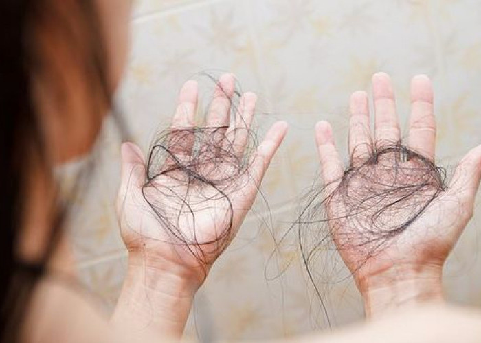 Cara Mengatasi Rambut Rontok, Mudah dan Praktis Pakai Bahan Alami
