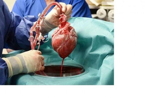 Transplantasi Jantung Babi ke Manusia Haram Atau Tidak? 