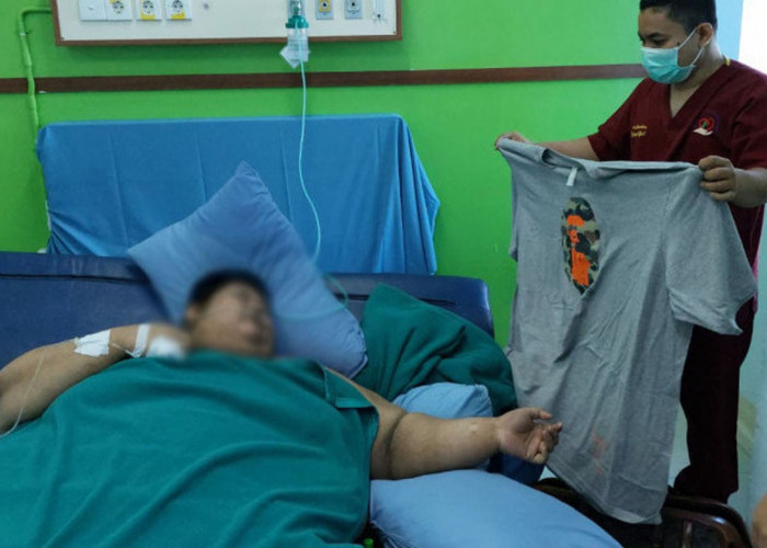 Moch Fajri Rifana Pria Obesitas di Tangerang Meninggal Dunia di RSCM