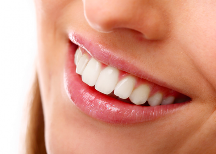 Tips Memutihkan dan Menyehatkan Gigi dengan Bahan Alami