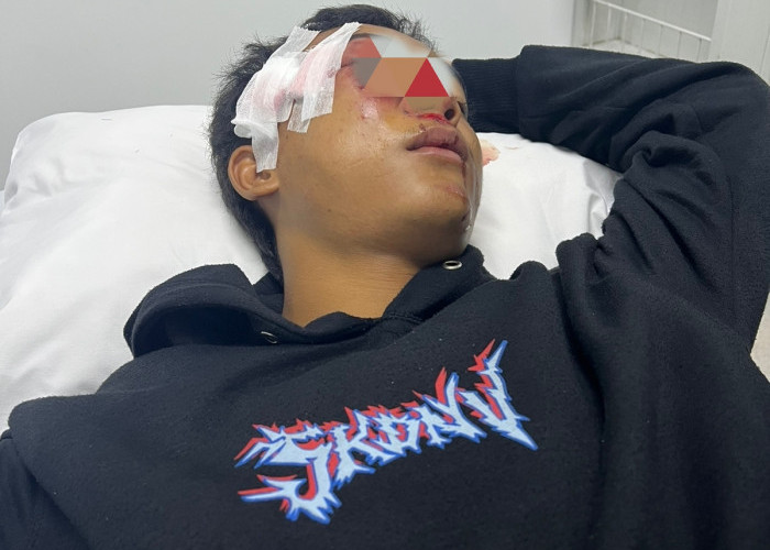Aksi Nekat Remaja, Tawuran di Depan Polsek Tigaraksa, Satu Terluka