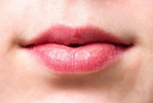Bibir Kering Pecah-pecah, Buka Mulut Saja Sakit? Ini Penyebabnya