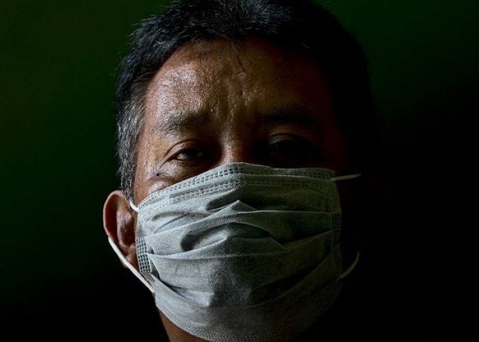 Gejala Tuberkulosis dan Cara Pengobatannya, Jangan Sepelekan Penyakit Mematikan Ini