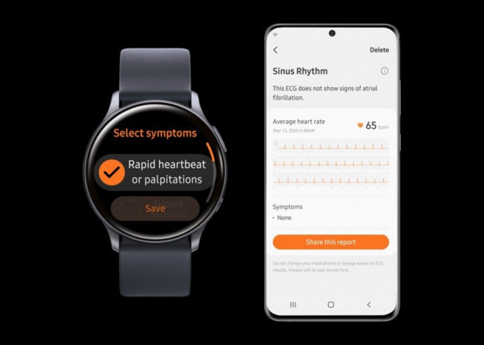 Deteksi Irama Jantungmu dengan Fitur Baru Samsung Galaxy Watch Ini
