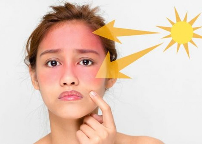 Tips Mencari Sunscreen yang Cocok Ketika Siang Hari, Jangan Sampai Membahayakan Kulit Cantikmu!