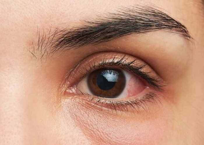 3 Tips Utama Menjaga Kesehatan Mata, Simak di Sini