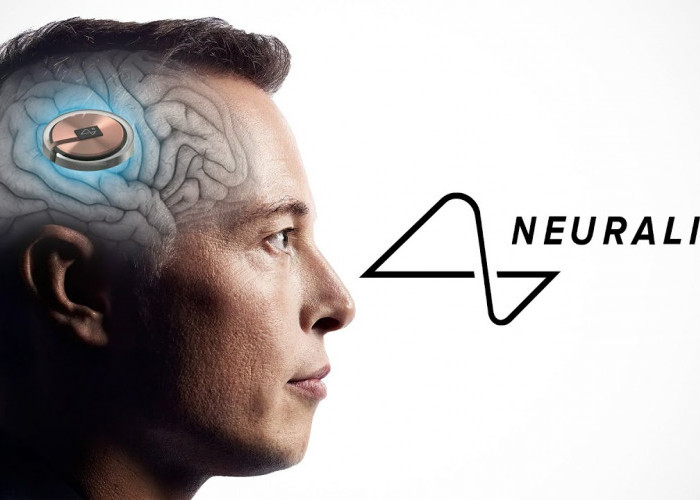 Neuralink Otak, Cara Elon Musk Pasang Implan di Kepala Manusia