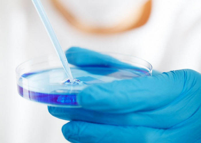 Kemenkes Gunakan Metode HPV DNA untuk Deteksi Dini Kanker Leher Rahim