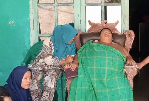 Innalillahi Wainnailaihi Rojiun, Bocah 11 Tahun Penderita Obesitas Seberat 126 Kilogram di Bekasi Meninggal