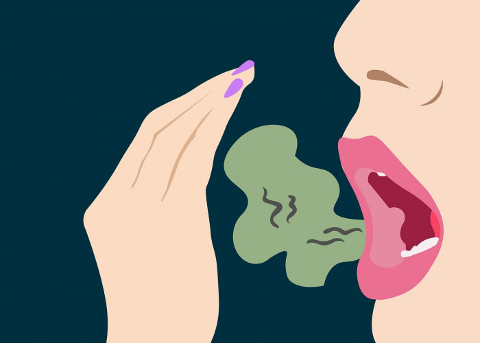 5 Tips Ampuh Menghilangkan Bau Mulut karen Gigi Berlubang