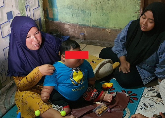Tidak Pernah Mendapat ASI, Bayi Obesitas di Bekasi Sering Konsumsi Susu Kental Manis