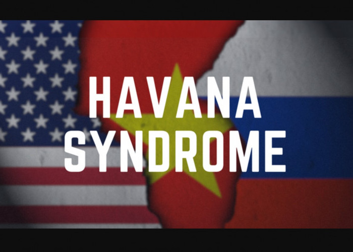 Intelijen militer Rusia Disebut Sebar Penyakit Sindrom Havana ke Diplomat Amerika 