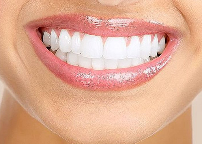 Tips Menjaga Kesehatan Gigi, Alternatif Alami untuk Ciptakan Gigi Kuat