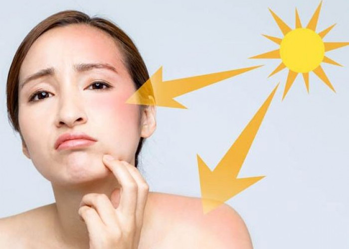 Rekomendasi Sunscreen untuk Menghindari Wajah Kusam, Lindungi Wajah Cantikmu!