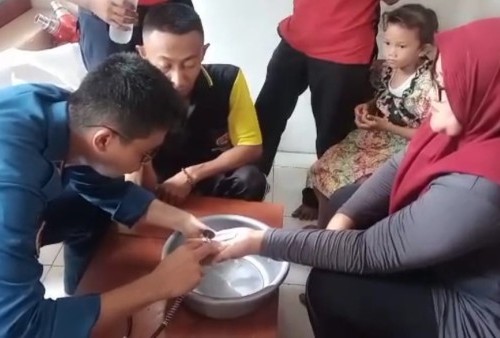 Cincin Tak Bisa Lepas, IRT di Tangerang Datangi Pos Damkar dengan Kondisi Tangan Bengkak dan Kemerahan