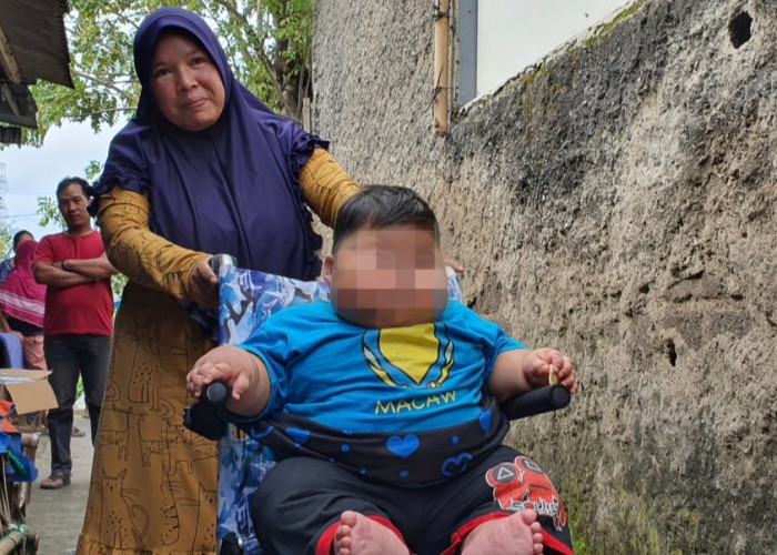 Bayi Obesitas di Bekasi dengan Berat 27 kg Mulai Menjalani Pemeriksaan Dokter Ahli