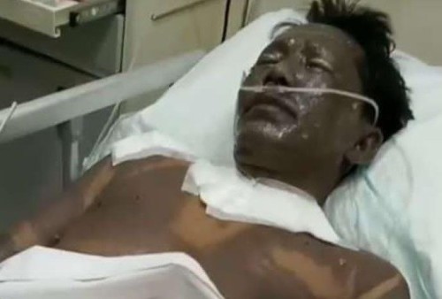 Soal Insiden Kecelakaan Kerja di Pabrik Baja, DPRD Kabupaten Tangerang Segera Panggil Pihak PT SMS Steel